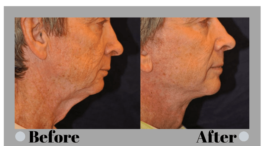 Beverly Hills Facelift Specialist Dr. Jason B. Diamond - Dr. Jason B. Diamond