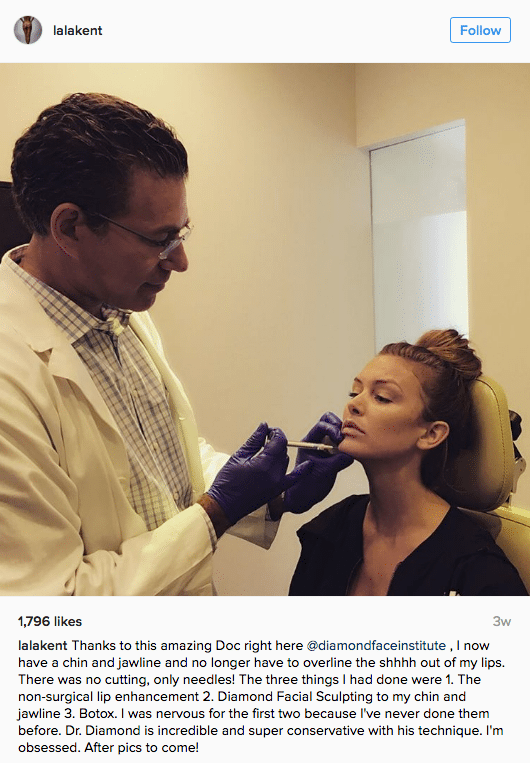 Lala Kent Gets Diamond Facial Sculpting®