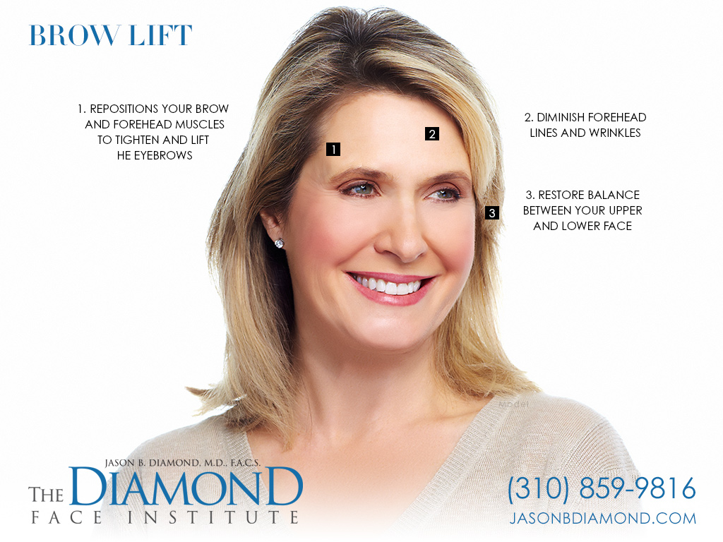 Infographic: Brow Lift | The Diamond Face Institute