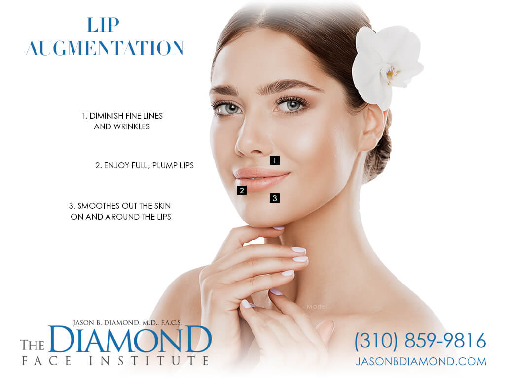 Infographic Lip Augmentation | The Diamond Face Institute Infographic Lip Augmentation | The Diamond Face Institute