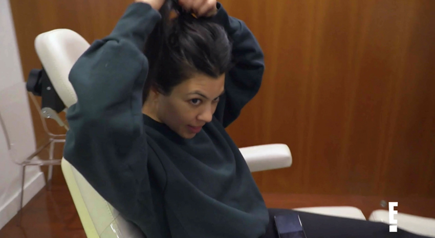kourtney-prp-scalp