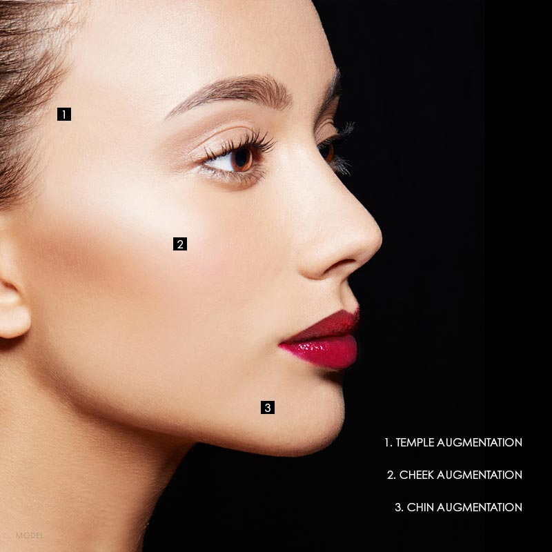 Customized Implant Options: Temple Augmentation, Cheek Augmentation, Chin Augmentation