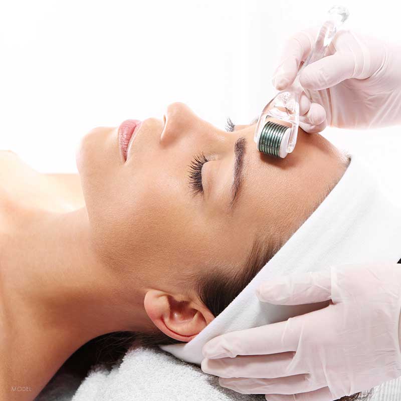 Step 3: Microneedling