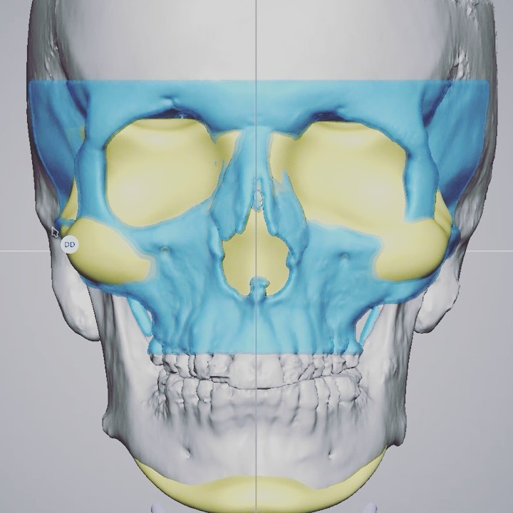 Dr. Diamond's Instagram Post 3