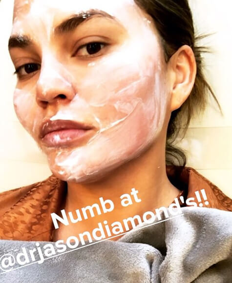 Chrissy Teigen