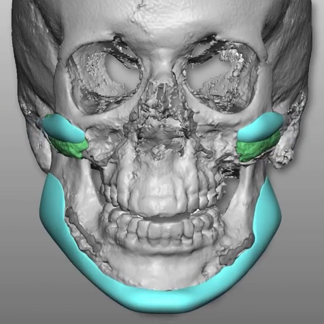 Dr. Diamond's Instagram Post 6