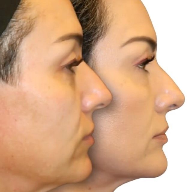 Dr. Diamond's Instagram Post 4