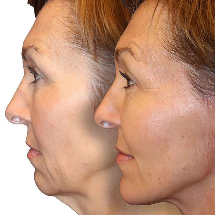 Dr. Diamond's Instagram Post 3