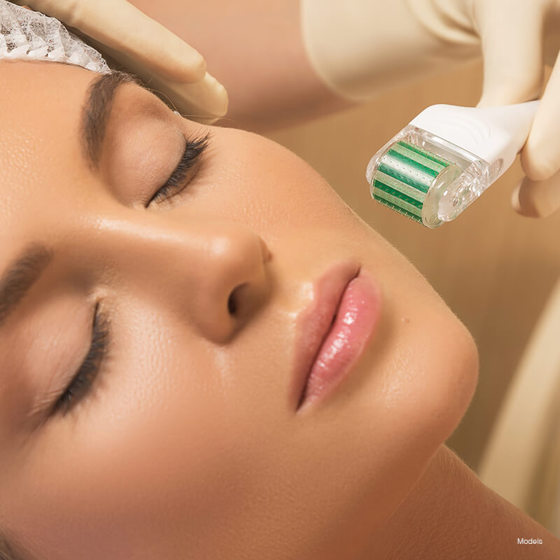 microneedling-featured-model