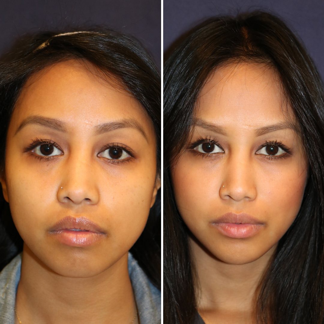 Dr. Diamond's Instagram Post 2