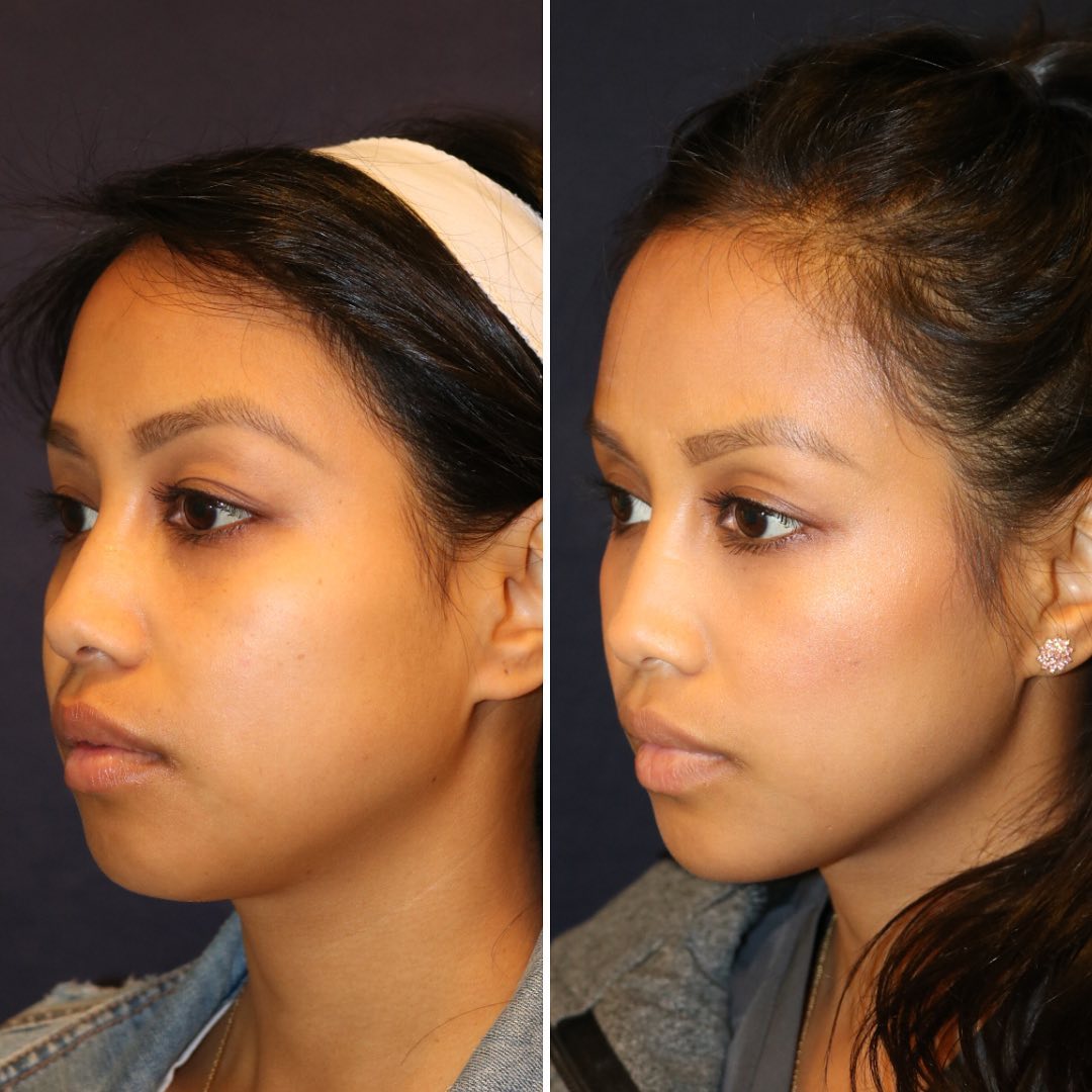 Dr. Diamond's Instagram Post 3