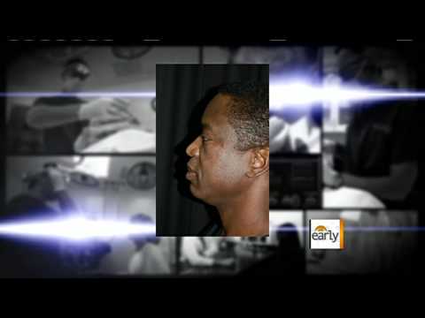 Plastic surgery for men on the rise