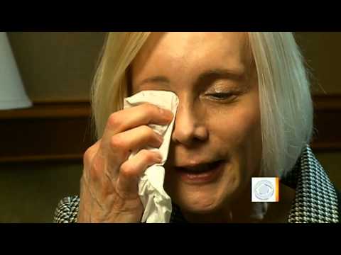 Eyelid surgery leaves woman unable to blink