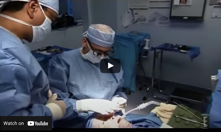 Dr. Diamond Performs Extreme Enhancements