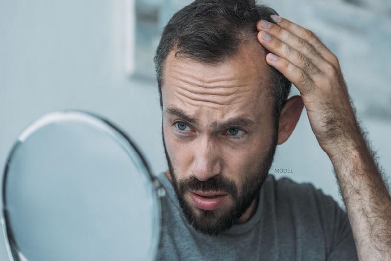 Has Every Other Hair Restoration Treatment Failed? Learn Your Alternative Options - Dr. Jason B. Diamond
