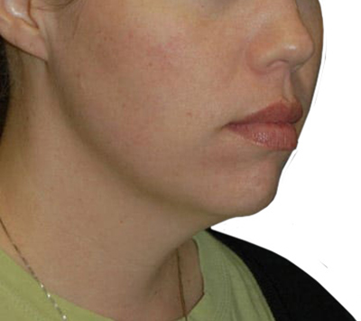 Before Image