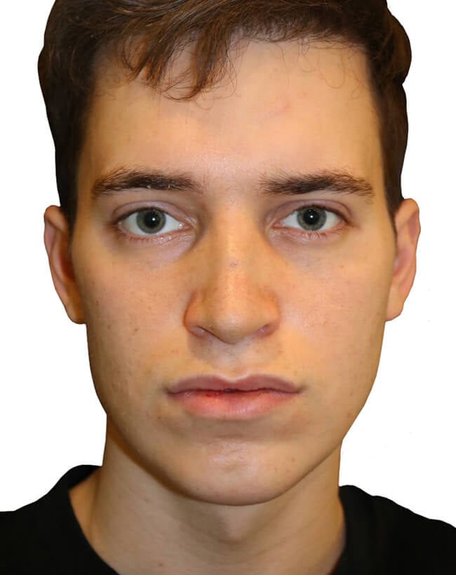 After Image