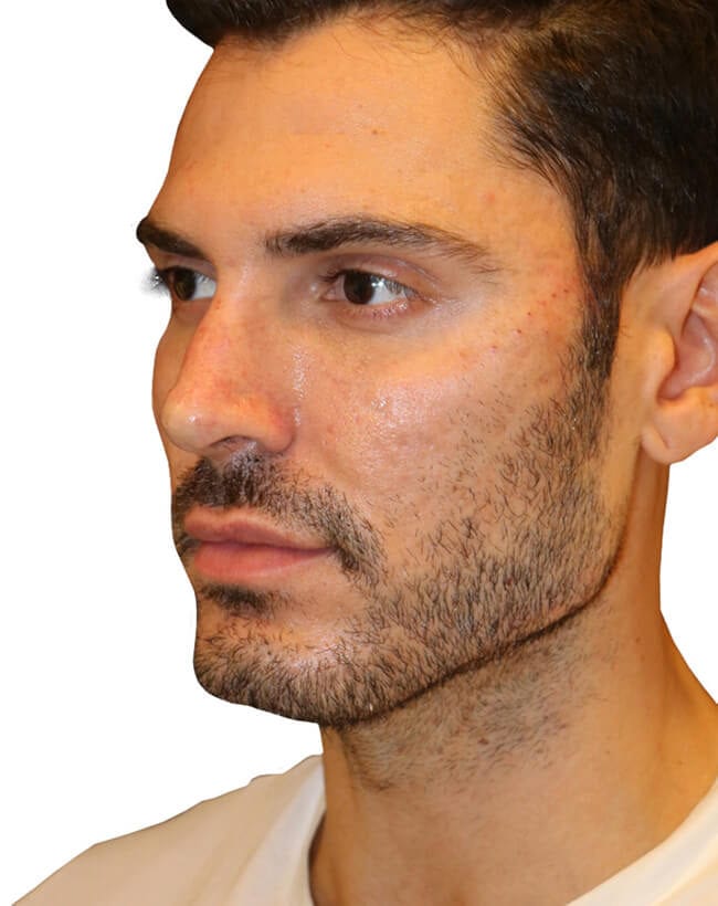 After Image