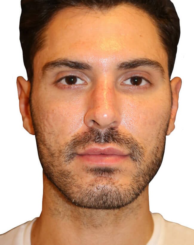 Before Image