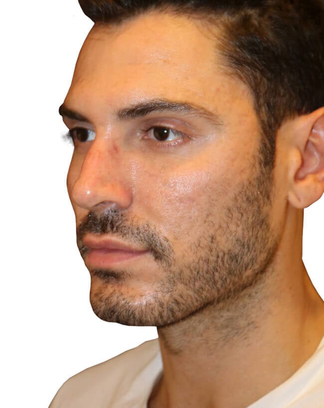 Before Image