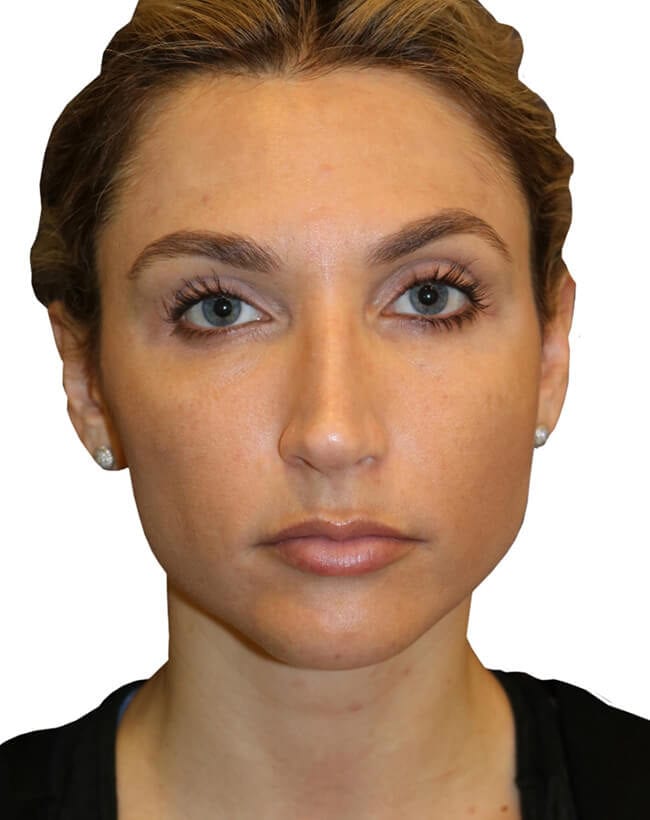 After Image