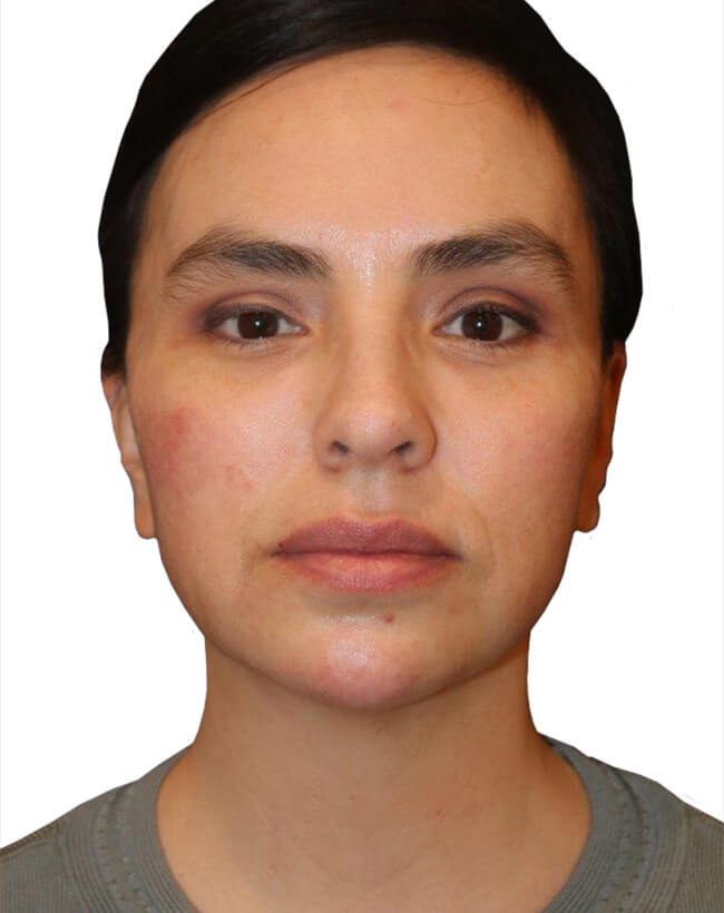 After Image