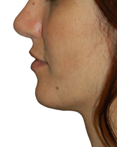 After Image