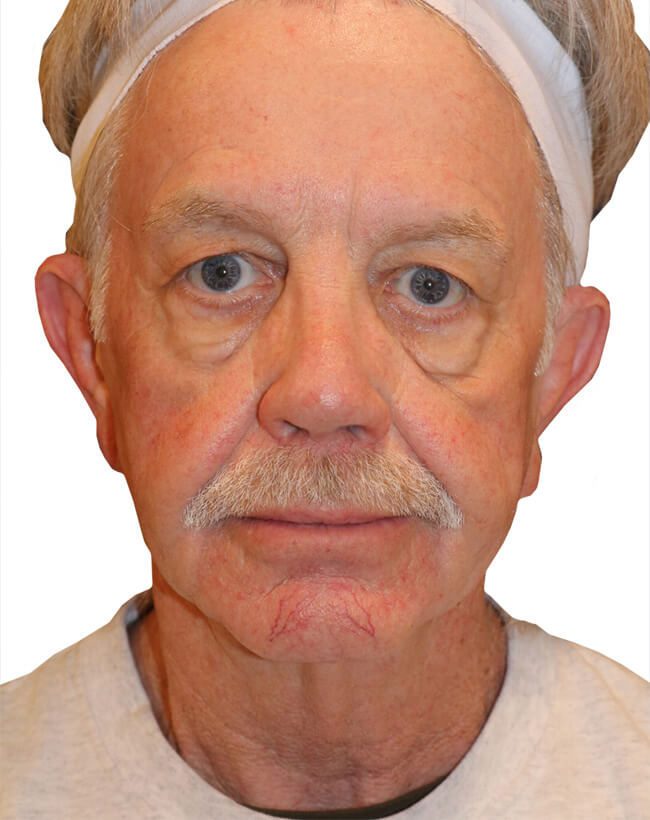 Before Image
