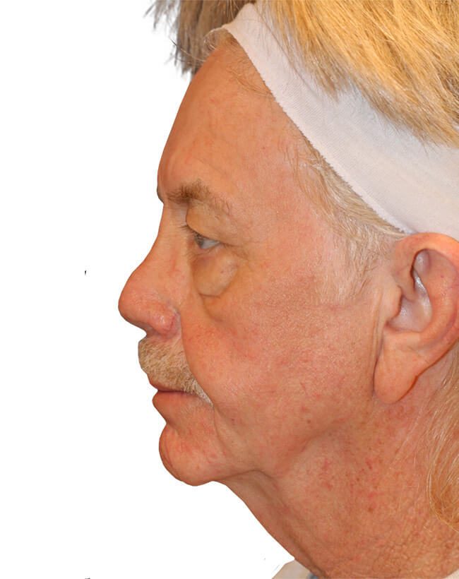 Before Image