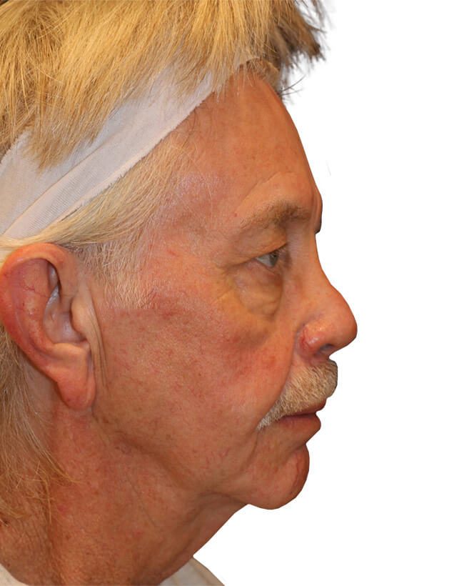 Before Image