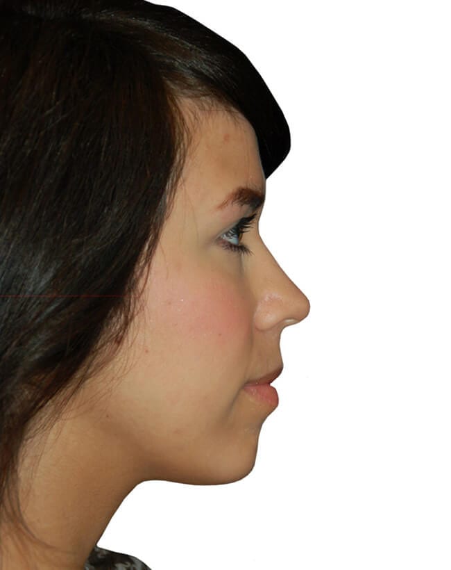 After Image