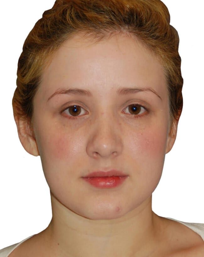 After Image