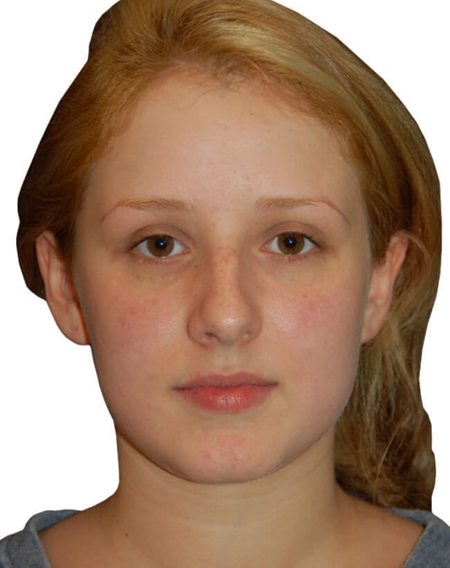 Before Image