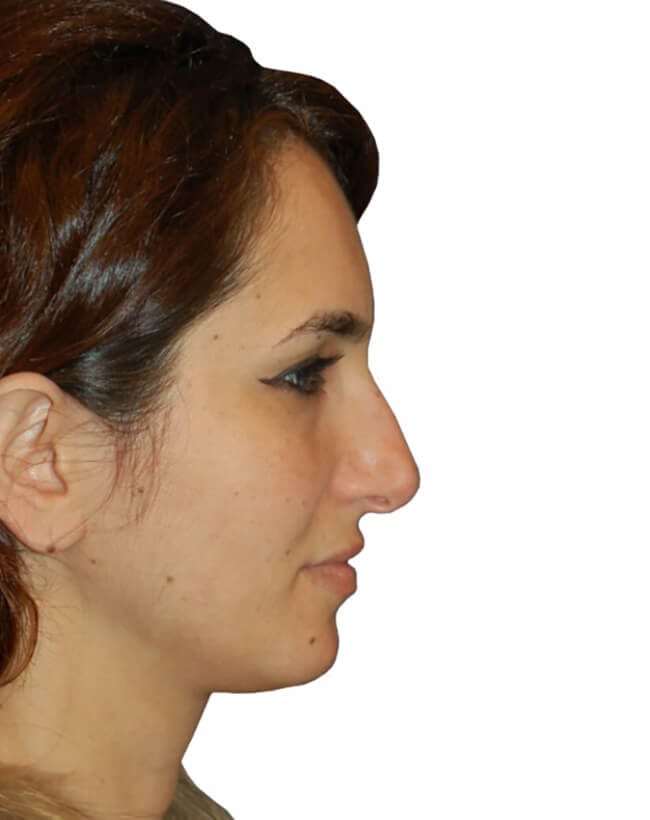 Before Image