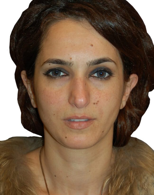 Before Image