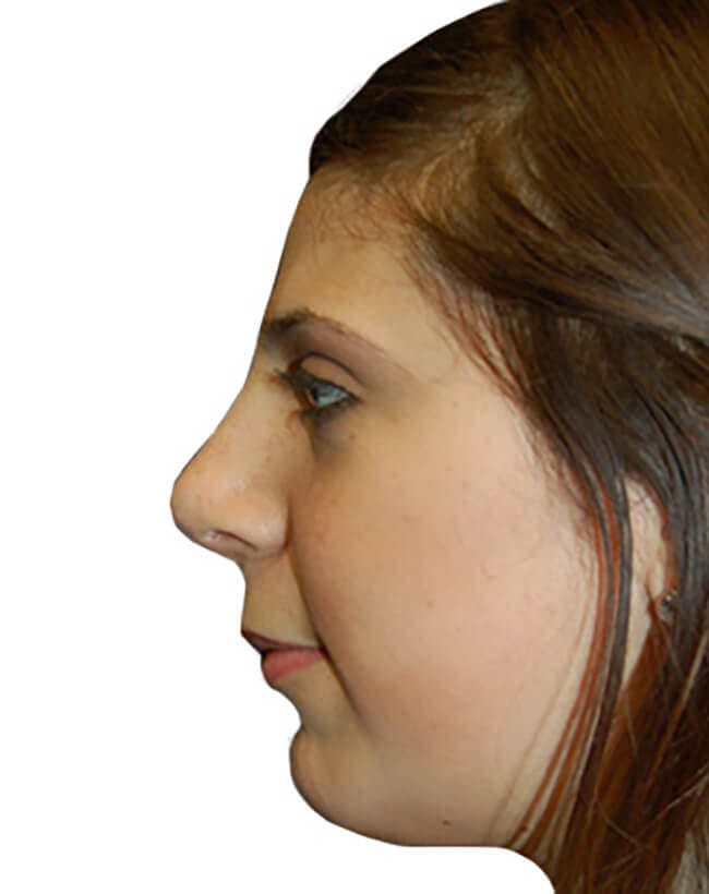 After Image