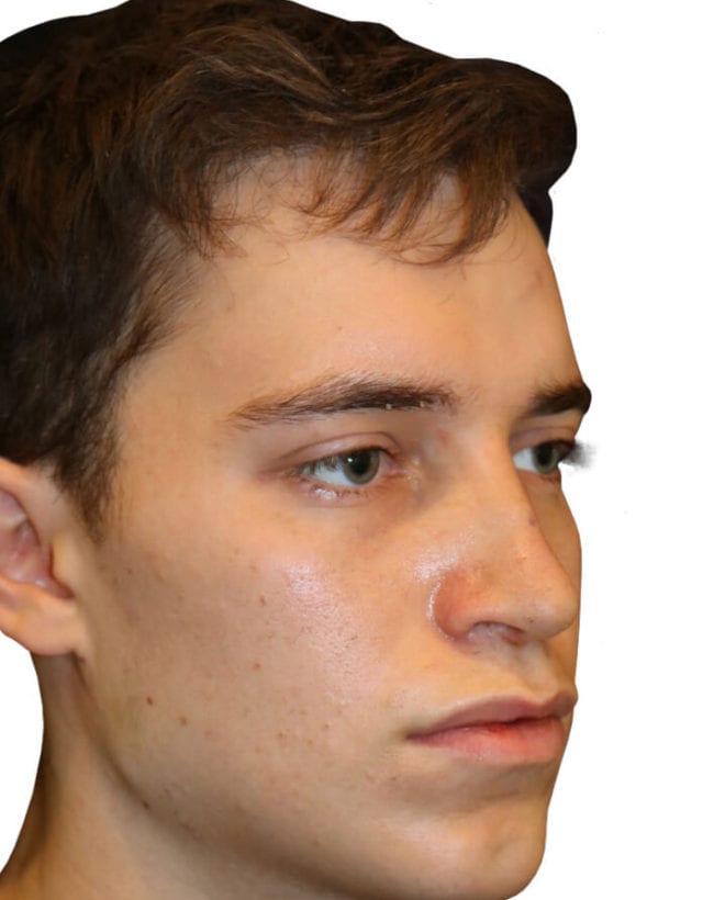 After Image